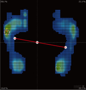 検証テータ　一般の靴　足圧