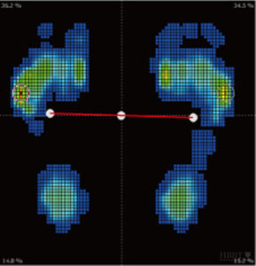 検証データ　ＢＡＬＡＮＣＥ工房3点バランスインソール　足圧