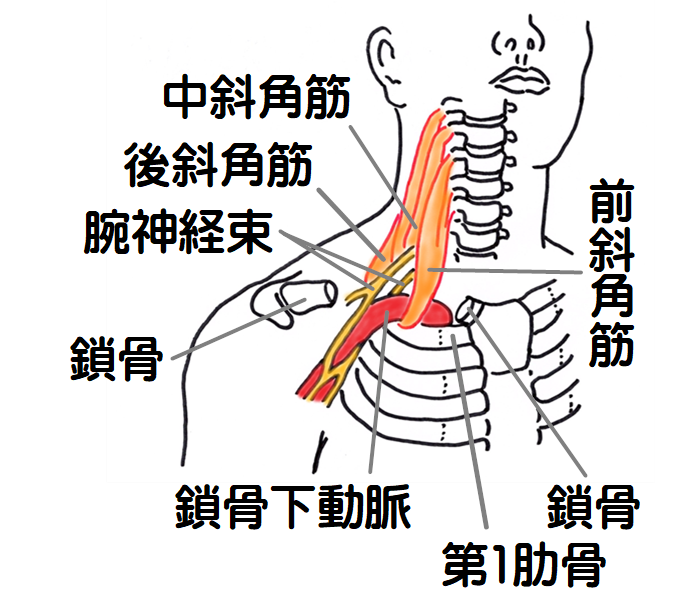 胸郭出口症候群　斜角筋症候群の図2