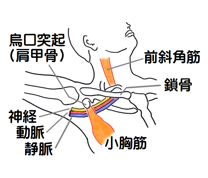 胸郭出口症候群　小胸筋症候群の図1