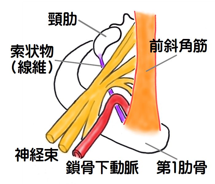 胸郭出口症候群　頸肋症候群の図2